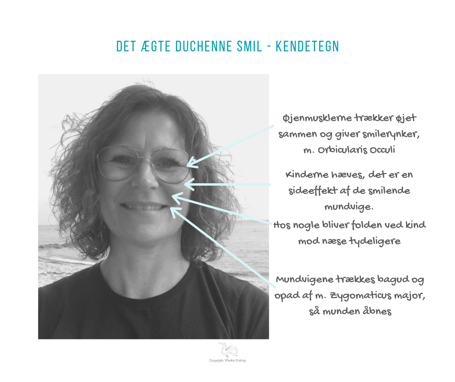 Smil - ægte Duchenne kendetegn